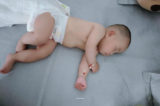 白银宝宝头上长痱子